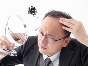 【島田市の探偵の不倫・浮気調査】急に薄毛を気にし始めた夫、理由はやっぱり不倫！
